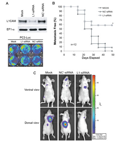 Effects of L1 cell adhesion molecule (L1CAM) downregulation on tumor metastasis in a PC3 xenograft model.