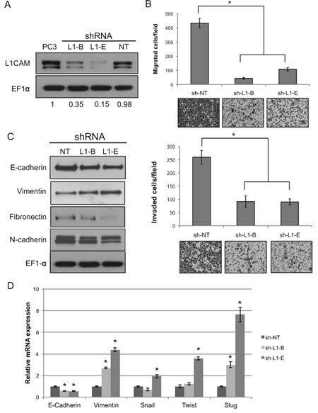 Effects of L1 cell adhesion molecule (L1CAM) gene knockdown on the migratory and invasive abilities of PC3 prostate cancer cells.