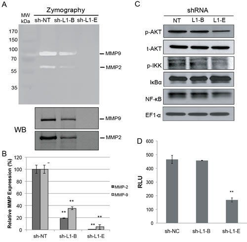 Effect of L1 cell adhesion molecule (L1CAM) shRNA on matrix metalloproteinase and nuclear factor NF-&#x3ba;B activation in prostate cancer PC3 cells.
