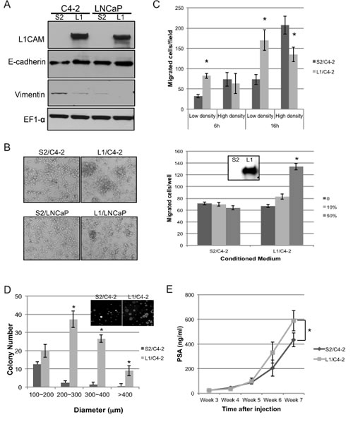 Effects of L1 cell adhesion molecule (L1CAM) overexpression in L1CAM-null prostate cancer cells.