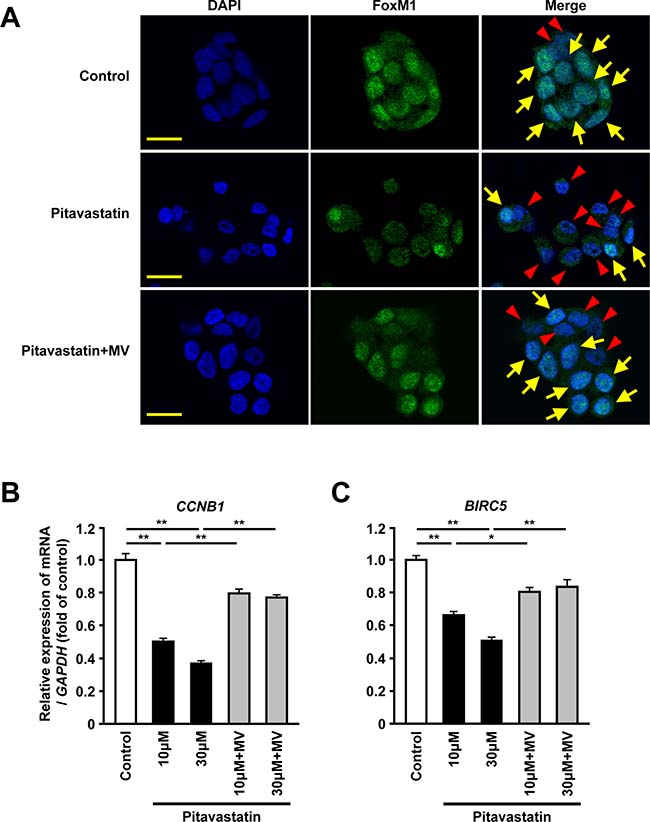 Inhibition of HMGCR decreases the nuclear expression and the transcriptional activity of FoxM1 in human hepatoma cells.