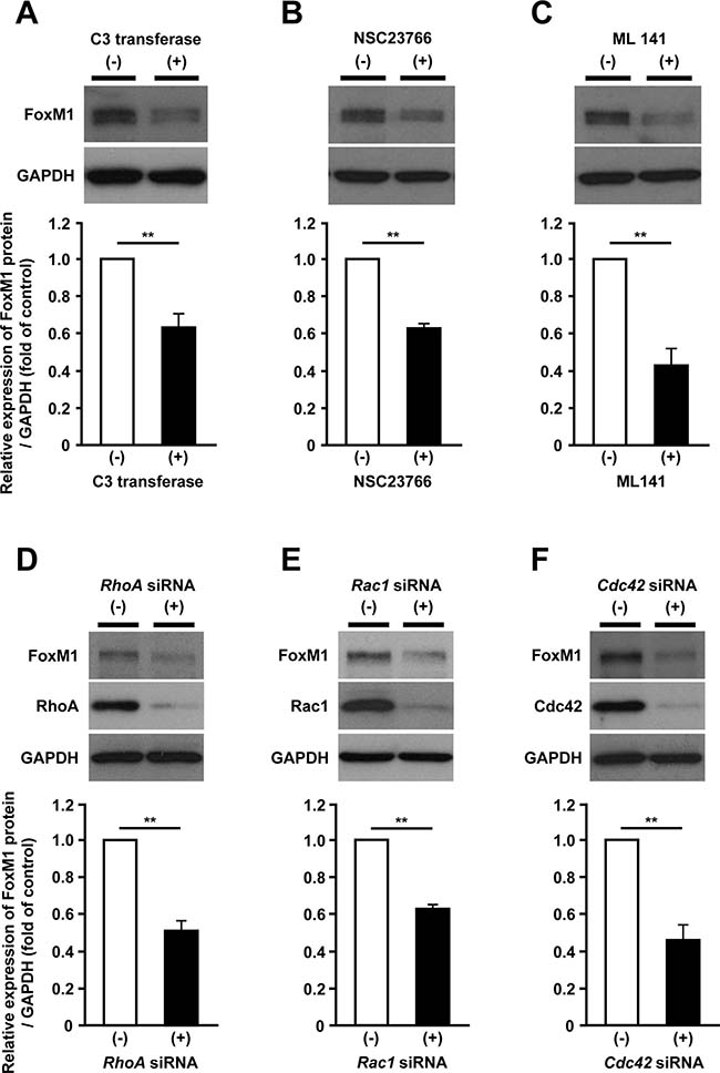 Rho family proteins are involved in the mevalonate pathway-dependent regulation of FoxM1.