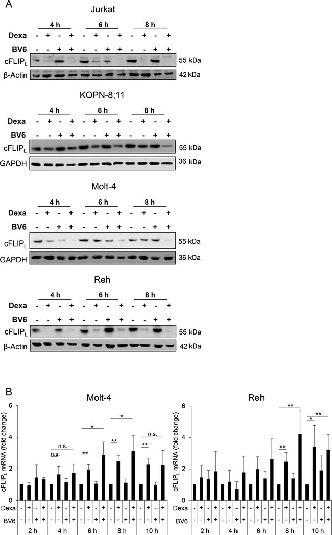 Dexa downregulates cFLIPL protein in ALL cells.