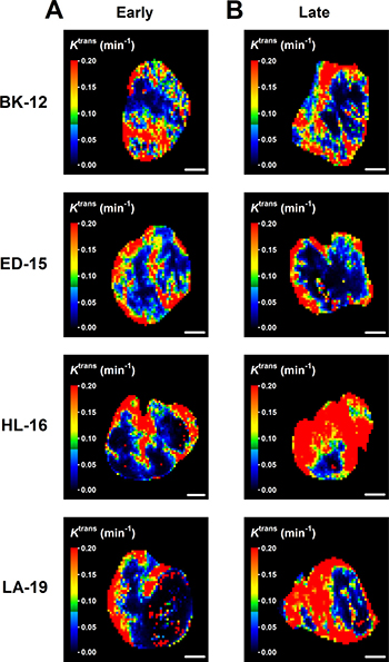 Dynamic contrast-enhanced magnetic resonance imaging-derived parametric images.