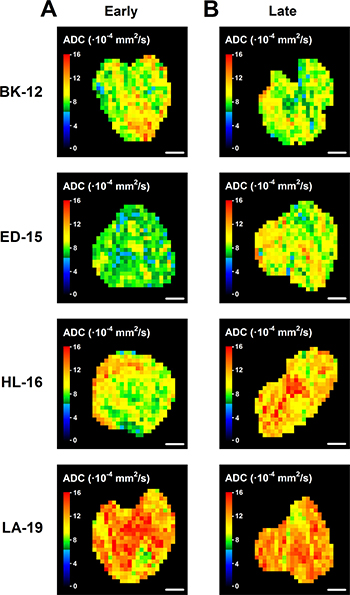 Diffusion-weighted magnetic resonance imaging-derived parametric images.