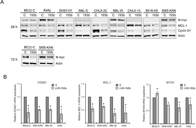 Figure 7 : miR-193b reduces the expression of Cyclin D1, MCL-1 and MYCN in neuroblastoma.