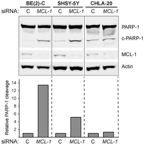 PARP-1 cleavage in response to MCL-1 knockdown in neuroblastoma.