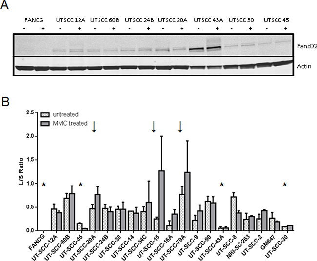 FANCD2-mono-ubiquitylation capacity in the HNSCC panel.