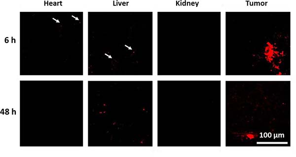 Confocal fluorescence images of histological samples derived from organs of mice that were treated with labeled DOX-nanogels at 1 mg kg-1.