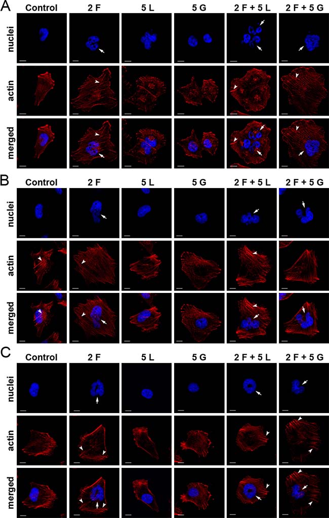 Effect of inhibitors on actin cytoskeleton organization and nuclei morphology of melanoma cells.