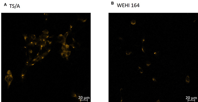 Immunohistochemistry of TNFR1 receptor in TS/A and WEHI 164 cell line.