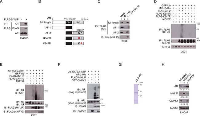 CNPY2 inhibits MYLIP-mediated AR ubiquitination and protein degradation.