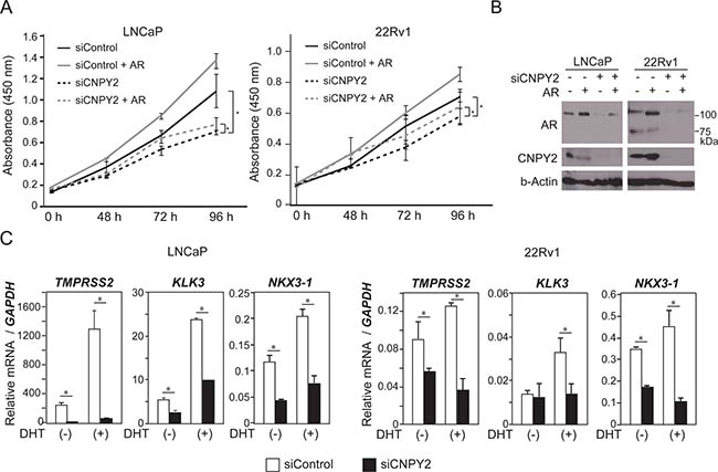 CNPY2 promotes prostate cancer cell growth through regulation of AR expression level.