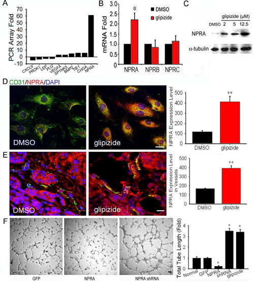 Glipizide inhibits angiogenesis through induction of NPRA expression.