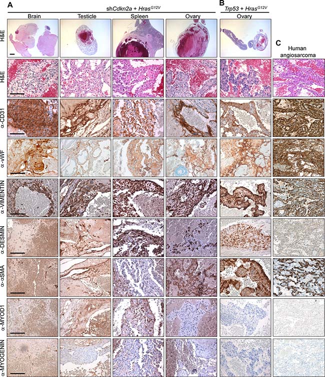 Histological and molecular characterisation of angiosarcomas.