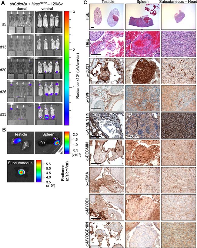 HrasG12V expression plus knockdown of Cdkn2a causes angiosarcomas and undifferentiated pleomorphic sarcomas in 129Sv mice.