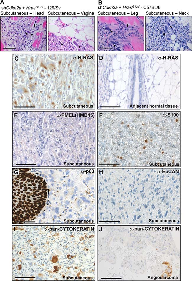 High grade, locally invasive undifferentiated pleomorphic sarcomas form in 129/Sv and C57BL/6 mice.