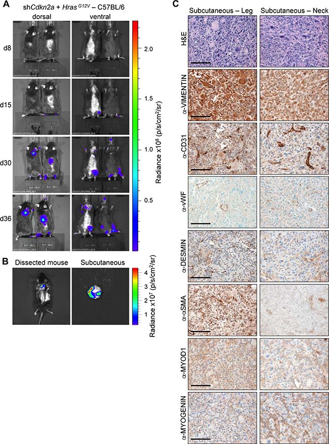 HrasG12V expression plus knockdown of Cdkn2a causes undifferentiated pleomorphic sarcomas in C57BL/6 mice.