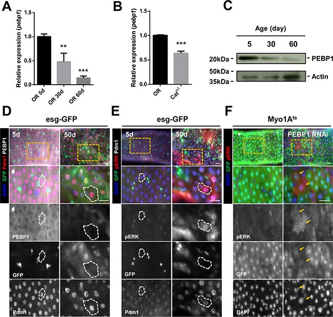 Decreased expression of PEBP1 is associated with increased ERK activity in ECs of aged midgut.