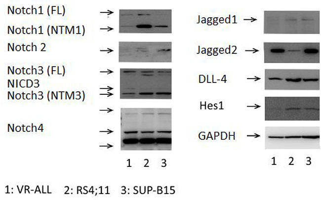 Notch expression and activation in B-ALL samples.