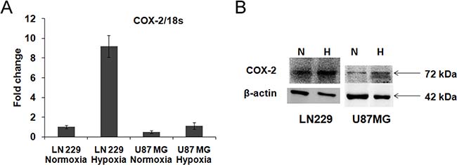 COX-2 expression in glioma cell lines.