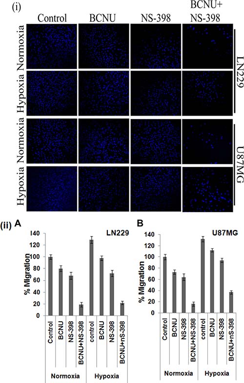 Cell migration as assessed by transwell membrane assay.