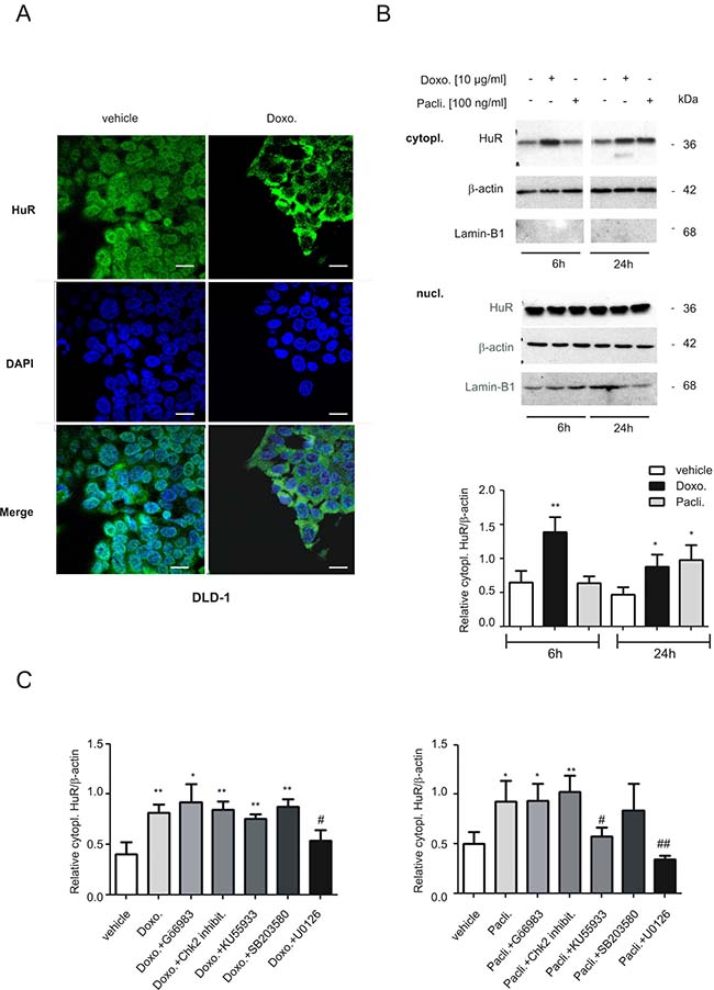 Modulation of nucleo-cytoplasmic HuR shuttling and binding to the 5&#x02B9;UTR-caspase-2 by chemotherapeutic drugs.