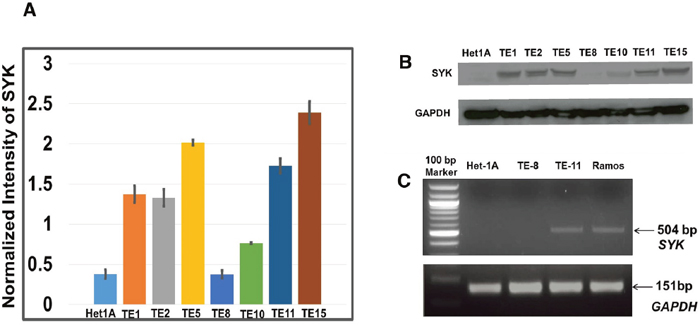 Expression of SYK across ESCC cell lines and non-neoplastic esophageal epithelial cell line.