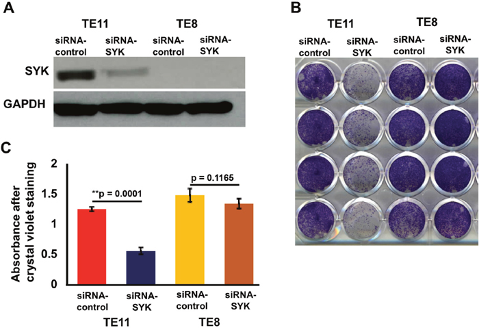 Effect of siRNA mediated knock down of SYK on cell proliferation, invasion/migration.