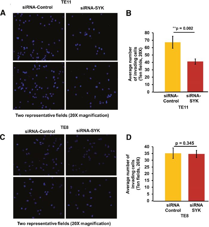 Effect of siRNA mediated knock down of SYK on invasion ability of TE11 and TE8 cell lines.