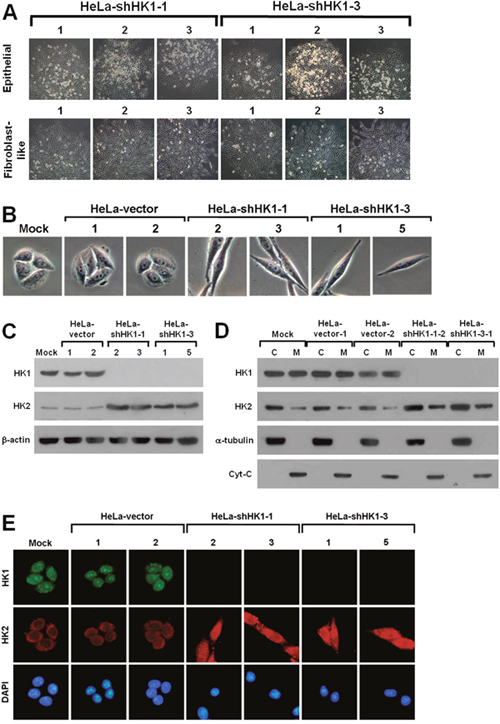 HK1 silencing induces a phenotypic switch.