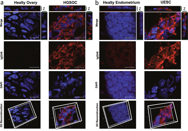 Mis-localized Claudin3 is a suitable target for tumor identification.