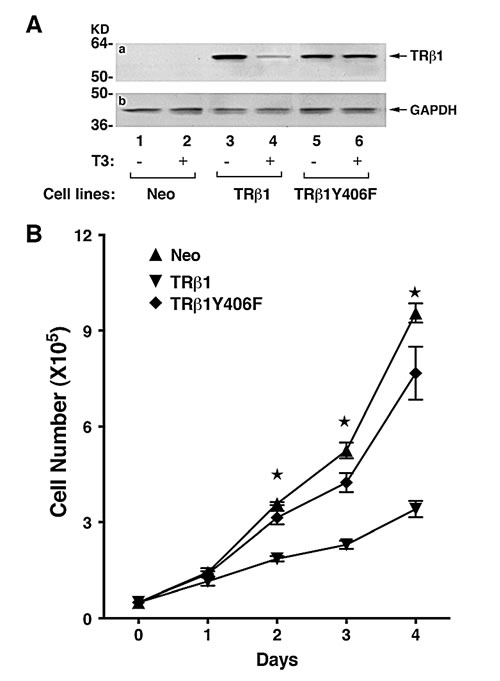 Comparison of growth rates of MDA-TR&#x3b2;1, MDA-TR&#x3b2;1Y406F and Neo control cells.