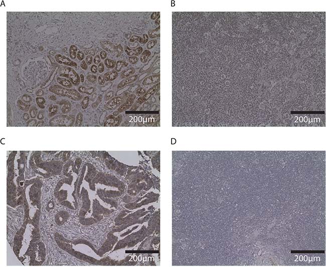 Immunohistochemistry