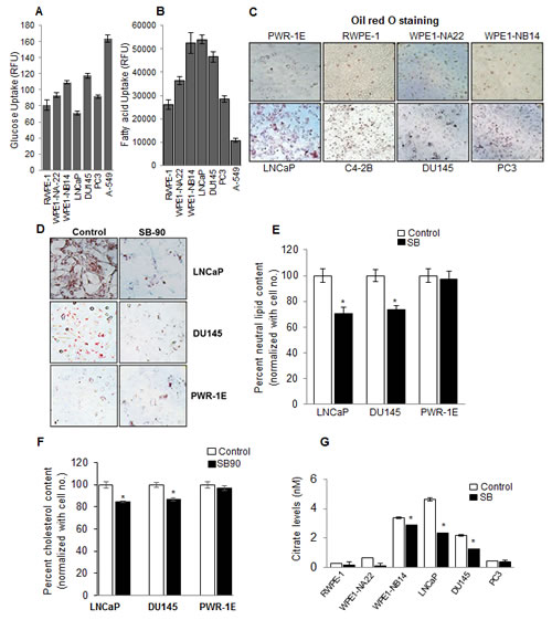 PCA cells exhibit a lipogenic phenotype, and silibinin inhibits neutral lipids, free cholesterol and citrate levels selectively in human PCA cells.