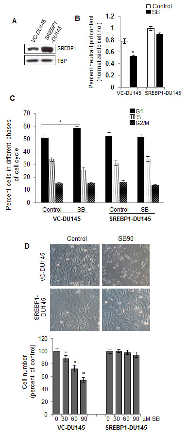 SREBP1 overexpression abrogates silibinin efficacy against PCA cells.