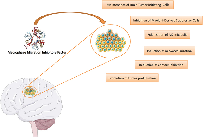 Involvement of MIF in the etiopathogenesis of glioblastoma.