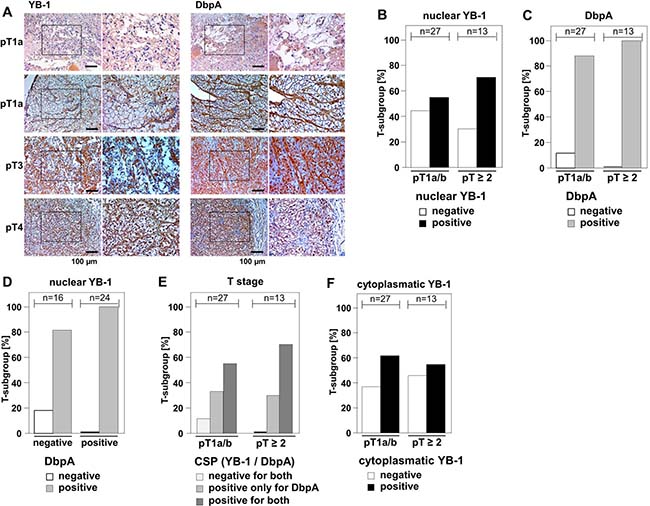 Overexpression of DbpA is associated with overexpression of YB-1 in clear cell renal cell carcinomas.