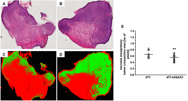 Effects of dual anti-platelet therapy with aspirin and clopidogrel on necrosis area in the primary tumour in orthotopic metastatic breast cancer model.