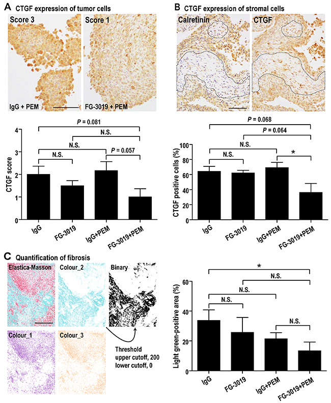 Effects of FG-3019 on CTGF expression and fibrosis.