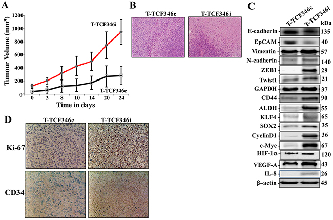 Let-7b-deficient breast stromal fibroblasts enhance orthotopic tumor growth.