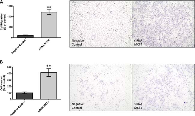 MCT4 silencing increases cell migration and invasion of JEG-3 cells.