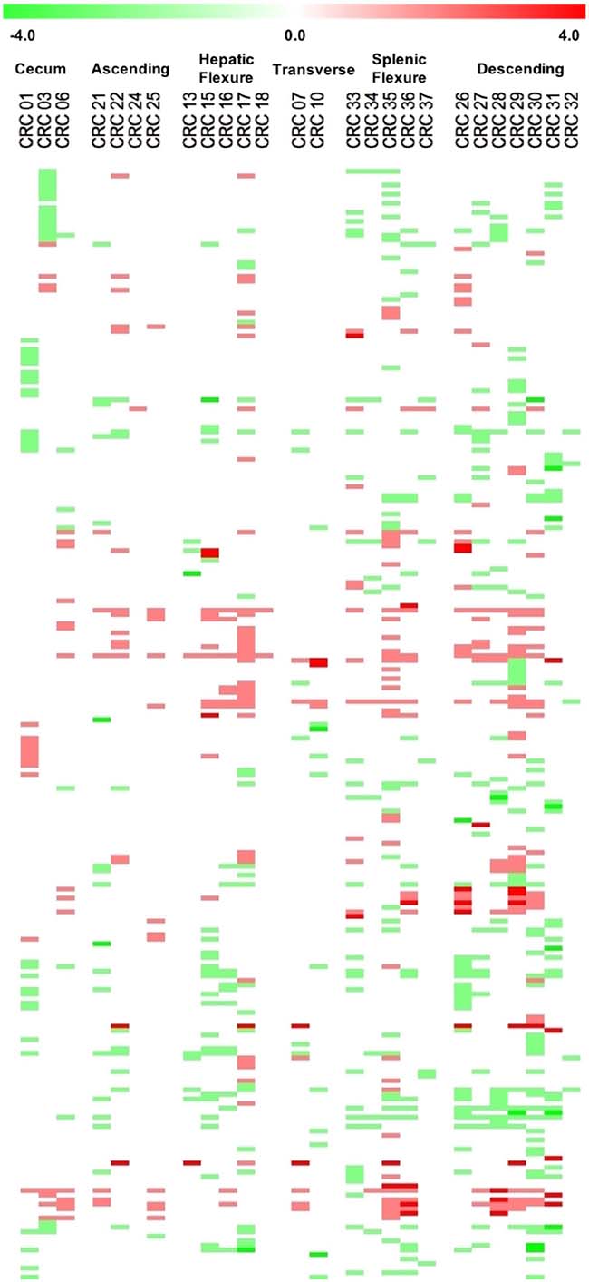 Heatmap representation of the data across all the cytobands harbouring CNAs ordered by chromosome position.