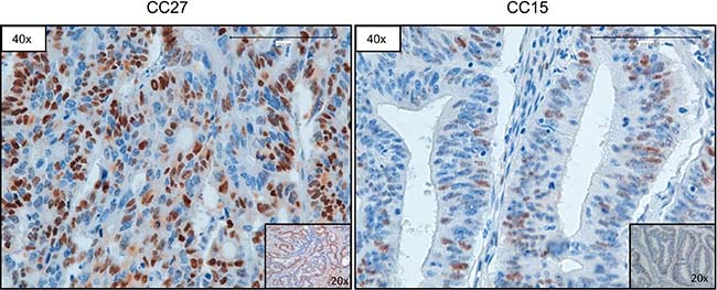 Representative images of CCND1 immunostaining.