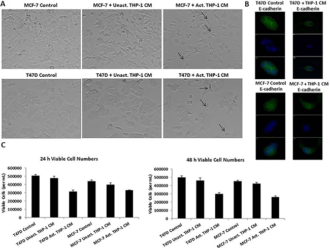 T47D and MCF-7 cells exhibited spindle-like morphology, decreased E-cadherin, and decreased viability viable cells following treatment with activated THP-1 CM.