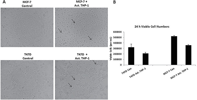Spindle-like morphology and reduced viability is observed following co-culture with activated THP-1 cells.