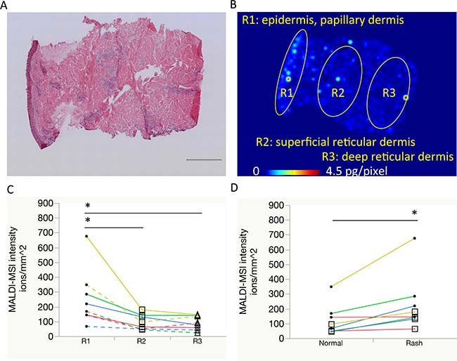 Comparison of erlotinib focal distribution using mass spectrometry imaging.