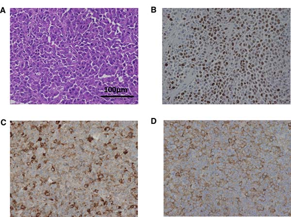 Histopathological images of tumor from control mice inoculated with TCC-NECT-2.