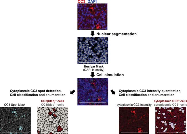 Figure 1: Workflow for enumeration of cleaved caspase-3 bleb?positive [CC3(bleb)+] cells in FFPE canine tumor tissue.