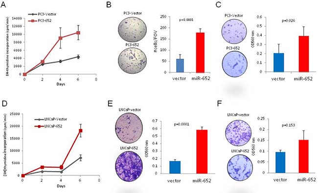 MiR-652 overexpression promoted PC3 and LNCaP prostate cancer cell growth migration and invasion.